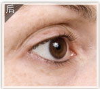 艺星塑美极 揭秘定格逆龄术，告别塑料网眼袋